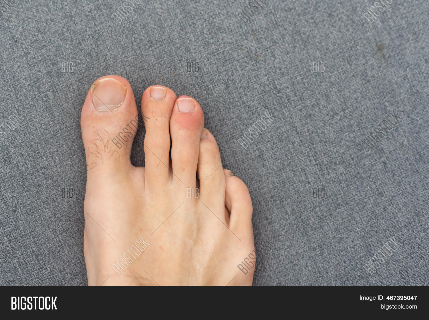 Man Toes Hair 图片和照片（免费试用） | Bigstock