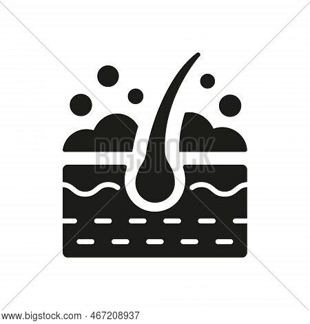 Hair Wash Silhouette Icon. Follicle Washing With Shampoo And Foam Black Glyph Pictogram. Treatment O