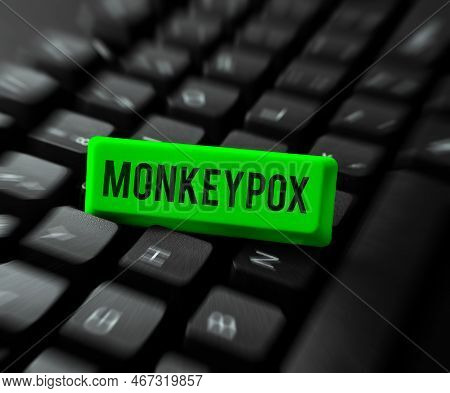 Text Sign Showing Monkeypox. Internet Concept Poxvirus Of Africa Caused By Chiefly In Wild Rodents A