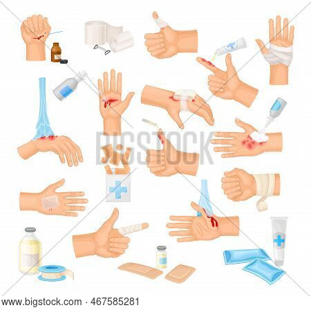Hands With Injured Skin And Procedures Of Bandaging And Wound Cleaning Big Vector Set