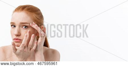 Young Caucsian Woman Squeezes Acne On The Face Of Beauty