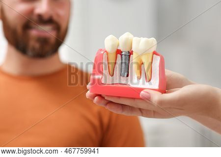 Doctor With Educational Model Of Dental Implant Consulting Patient In Clinic, Closeup