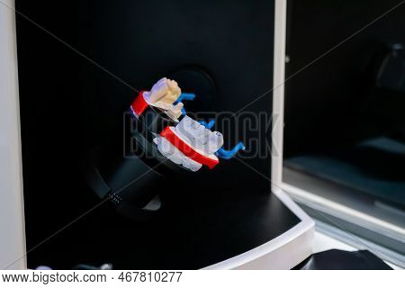 Automatic 3d Dental Scanner For Dental Gypsum Model Scanning And Measuring With Rotating Platform. S