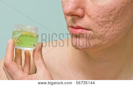 Problematic Skin Treatment