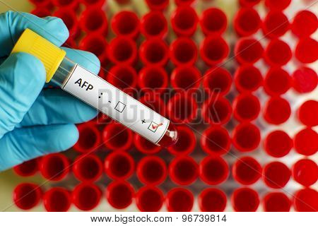 AFP positive