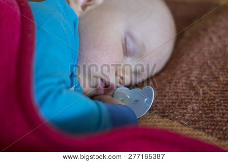 Sleeping Baby With Manifestations Of An Allergy On The Face