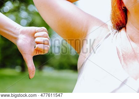 Sweaty Armpit Woman With Wet Spot On Clothes. Armpit Plump Middle-aged Woman, In Summer Clothes, Wit