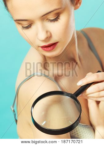 Woman Using Magnifying Glass To Examine Her Moles Skin