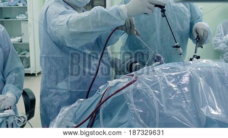 Laparoscopic surgery of the abdomen. The team of medical specialists conducting laparoscopic surgery.