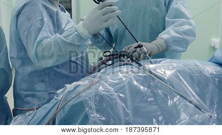 Laparoscopic surgery of the abdomen. The team of medical specialists conducting laparoscopic surgery.