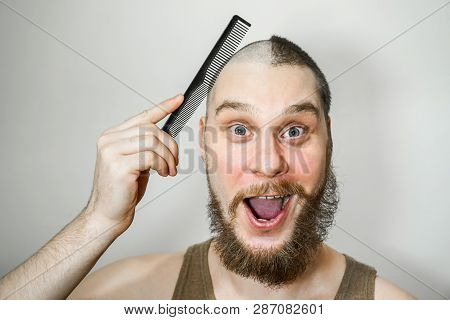 Half Trimmed Surprised Guy: On The One Hand Bald, On Other With Hair On Gray Background. Man Combing