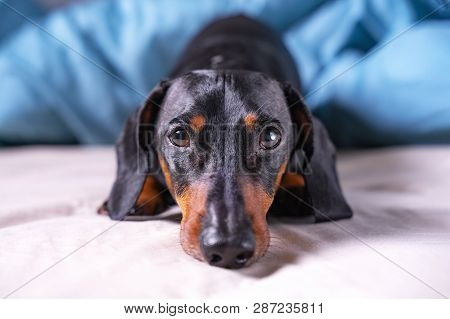 Cute A Dachshund Dog, Black And Tan Sleeping On  Human Bed, Sadly Looking At Camera