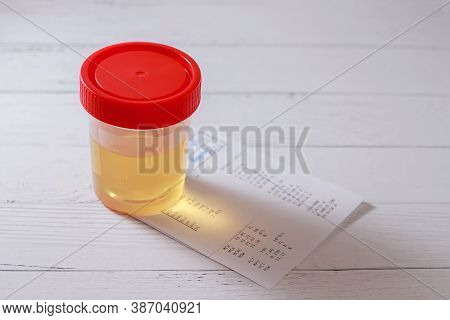 Urine Sample In Container With Medical Report