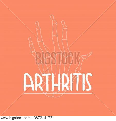 Vector Illustration On The Theme Of World Arthritis Day On October 12. Decorated With A Handwritten 