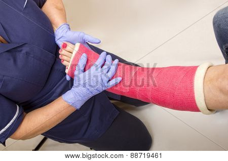 Ladies leg in Cast being treated by a Nurse