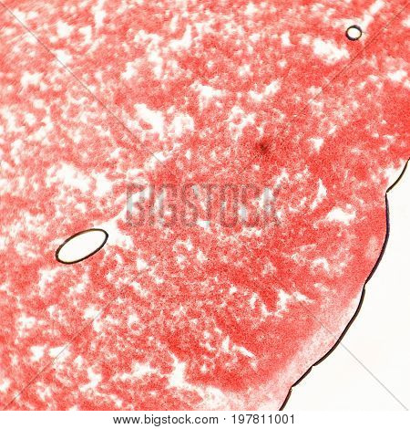 Blood Smear Under Microscope Present Neutrophils And Red Blood Cells. Photo Micro Sections With High