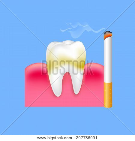 Tooth With Cigarette. Smoking Effect On Human Teeth. Dental Care Concept. Stop Smoking, World No Tob