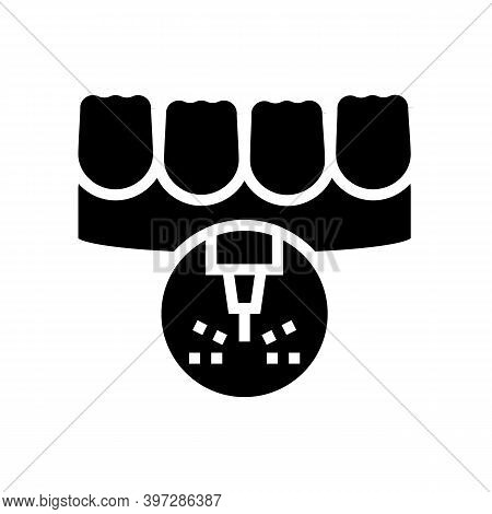 Stomatology Teeth Laser Treatment Glyph Icon Vector. Stomatology Teeth Laser Treatment Sign. Isolate