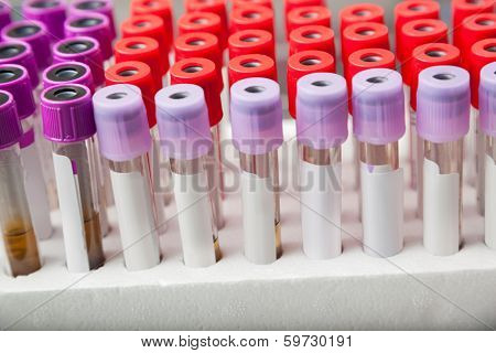 Rack of test tubes in medical laboratory