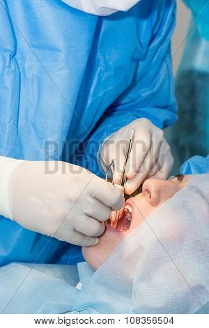 Dentists during surgery for implant placement