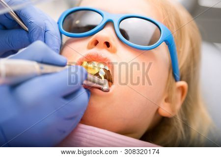 Dentist performing dental procedure to a little girl in pediatric dental clinic. Doctor using prophy brush on handpiece to polish filling. Calm child is sitting in a dental chair wearing sunglasses