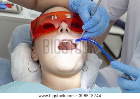 Girl Patient At The Reception At The Dentist. Treatment Of Carious Tooth. The Girl Lies On The Denta