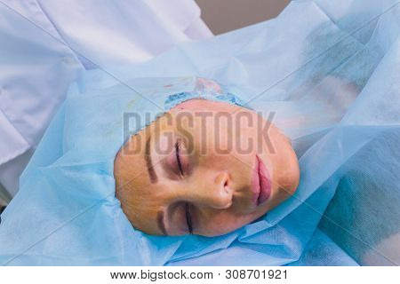 Aged Woman Doing Mesothreads And Thread Lifting, Cosmetology. Cosmetic Procedure To Eliminate Signs 