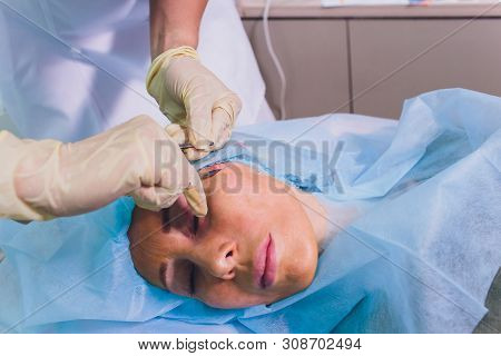 Aged Woman Doing Mesothreads And Thread Lifting, Cosmetology. Cosmetic Procedure To Eliminate Signs 