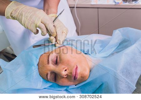 Aged Woman Doing Mesothreads And Thread Lifting, Cosmetology. Cosmetic Procedure To Eliminate Signs 