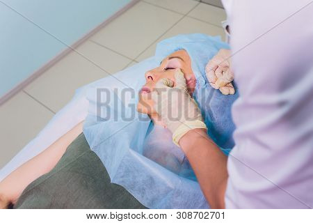 Aged Woman Doing Mesothreads And Thread Lifting, Cosmetology. Cosmetic Procedure To Eliminate Signs 