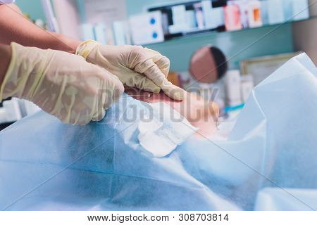Aged Woman Doing Mesothreads And Thread Lifting, Cosmetology. Cosmetic Procedure To Eliminate Signs 
