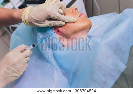 Aged Woman Doing Mesothreads And Thread Lifting, Cosmetology. Cosmetic Procedure To Eliminate Signs 