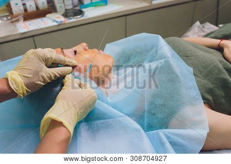 Aged Woman Doing Mesothreads And Thread Lifting, Cosmetology. Cosmetic Procedure To Eliminate Signs 