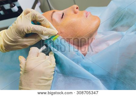 Aged Woman Doing Mesothreads And Thread Lifting, Cosmetology. Cosmetic Procedure To Eliminate Signs 