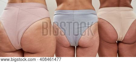 Women Demonstrating Their Saggy Buttoks In Beige, Blue And White Underpants To A Camera