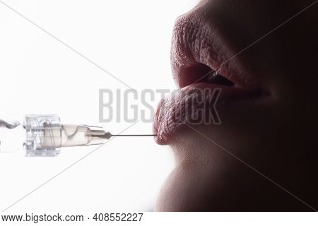 Lips Augmentation Syringe. Female Mouth, Hyaluronic Acid Injection, Augmentation. Age Changes. Cosme