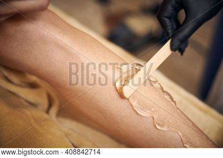Closeup Of Woman's Leg And Aesthetician's Hand Applying A Transparent Gel With Spatula Before Laser 