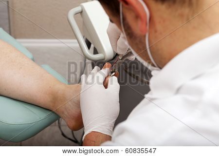Chiropodist Cutting Nails