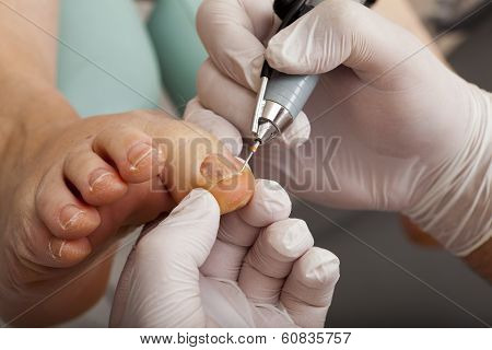 Medical Foot Care