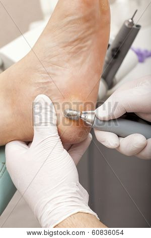 A Chiropodist Make Foot Care