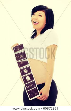 A pregnant woman is holding her stomach and a photo of her Ultrasound.