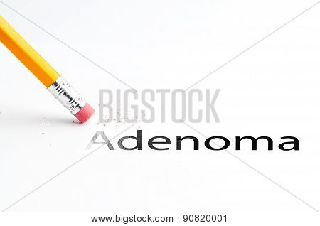 Pencil with eraser