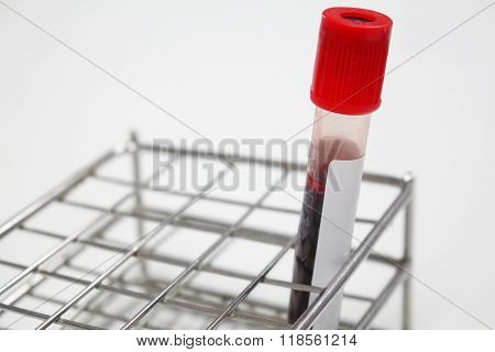 Blood sample in a test tube Vacutainer