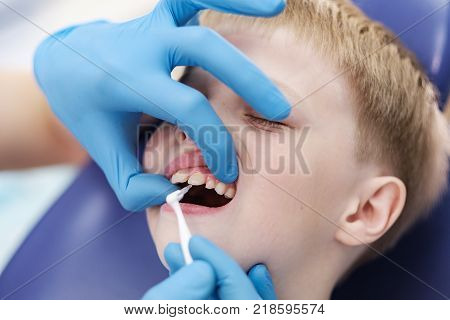 Male dentist examines the teeth of the patient cheerful child with blond hair. Boy smiling in dentist's chair with mouth wide open.