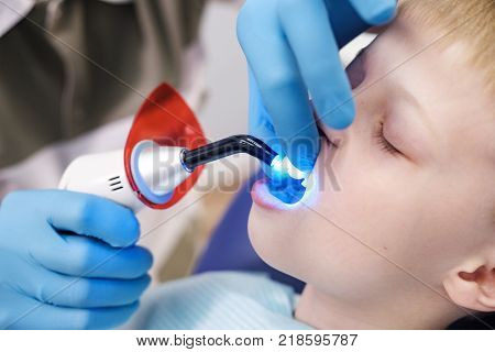 Male dentist examines the teeth of the patient cheerful child with blond hair. Boy smiling in dentist's chair with mouth wide open.