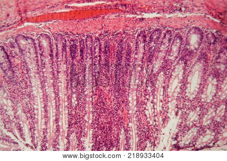Section Of The Cardiac Region Of A Dog Stomach