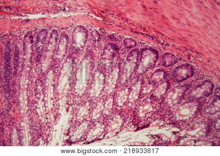 Section Of The Cardiac Region Of A Dog Stomach