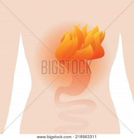 Gastritis. aching stomach. Vector illustration on a white background