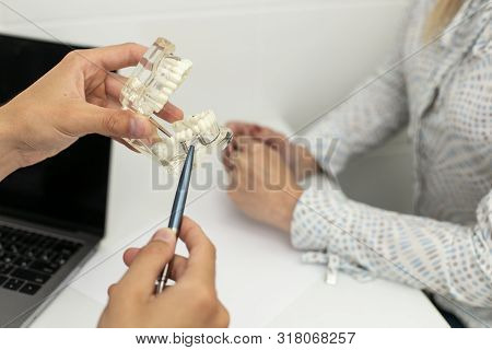 Professional Dentist Shows Model Of Jaw To His Client. Slective Focus