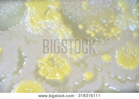 Colony Of Bacteria In Culture Medium Plate, Microbiology.